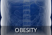 Obesity